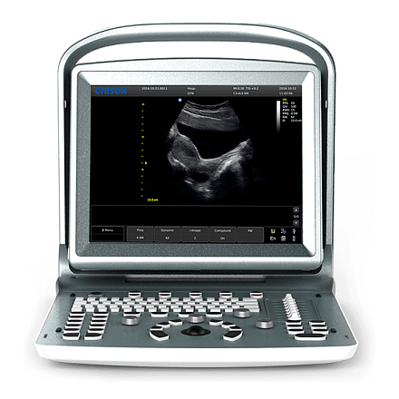 УЗИ аппарат Chison ECO 5