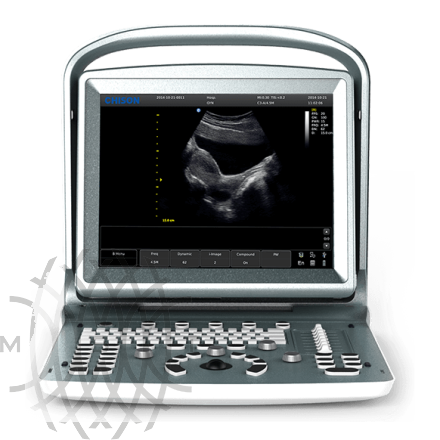 УЗИ аппарат Chison ECO 5