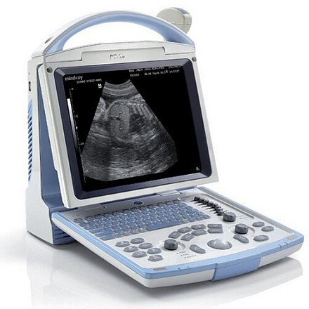 УЗИ аппарат Mindray DP-10 Vet портативный