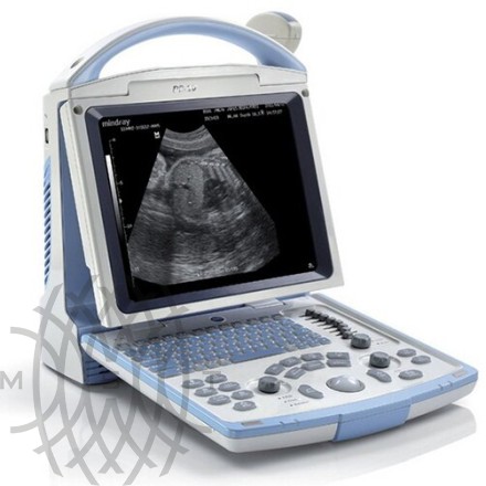УЗИ аппарат Mindray DP-10 Vet портативный