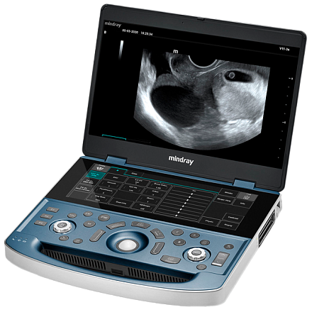 УЗИ аппарат Mindray MX8 Exp портативный