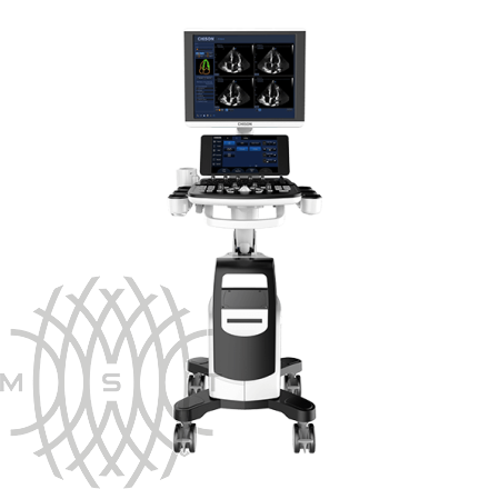 Chison CBit 8 аппарат УЗИ