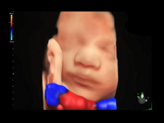 GE Voluson E10 аппарат УЗИ