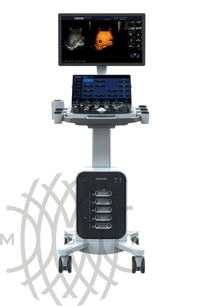 УЗИ аппарат Chison SonoMax 7