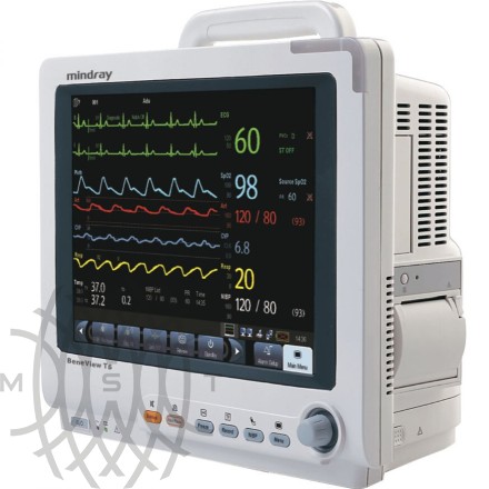 Mindray BeneView T6 bemor monitori
