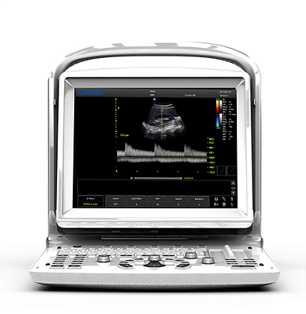 Ultratovush apparati Chison ECO 3 Expert