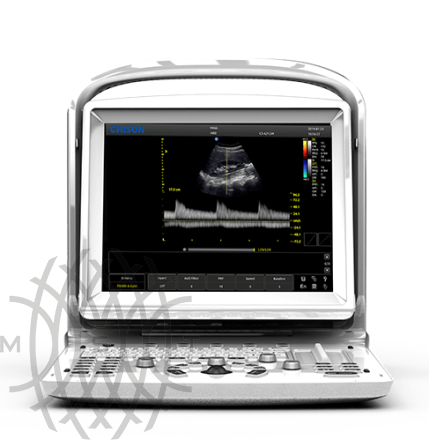 Ultratovush apparati Chison ECO 3 Expert