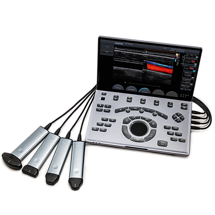 Портативный ультразвуковой сканер Chison SonoAir