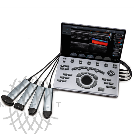 Портативный ультразвуковой сканер Chison SonoAir