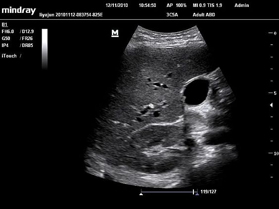 Mindray DC-N6 ультразвуковой аппарат