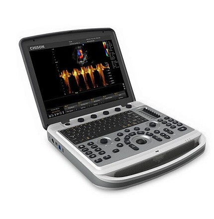 Ultratovush apparati Chison SonoBook 8