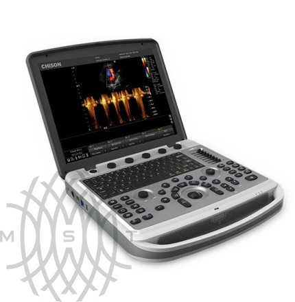 Ultratovush apparati Chison SonoBook 8