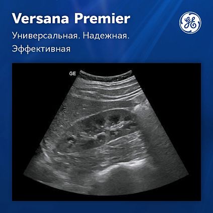 Ультразвуковая система GE Versana Premier Platinum