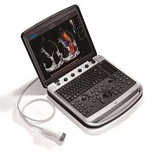 УЗИ аппарат Chison SonoBook 9