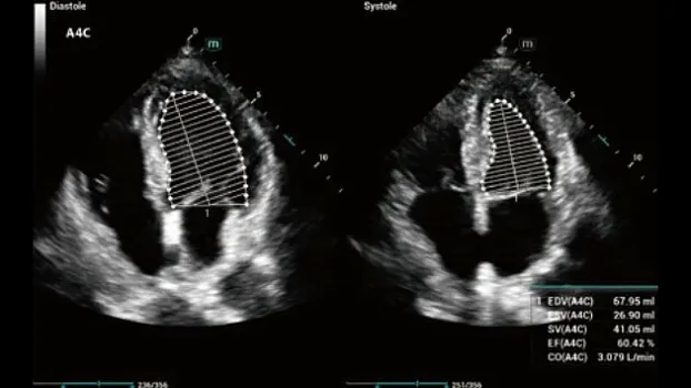 Mindray Consona N7 ультразвуковой аппарат