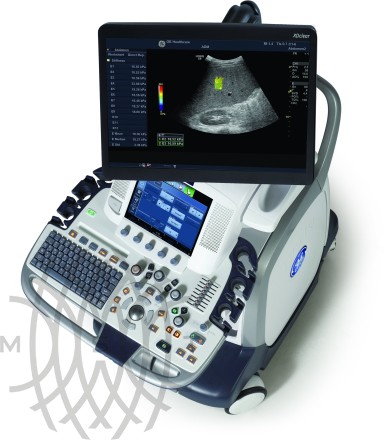 GE Logiq E9 XDclear ultratovush apparati