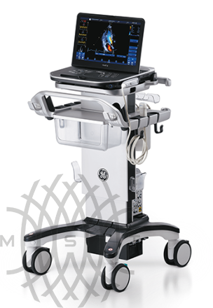 GE Vivid iQ portativ ultratovush diagnostika tizimi