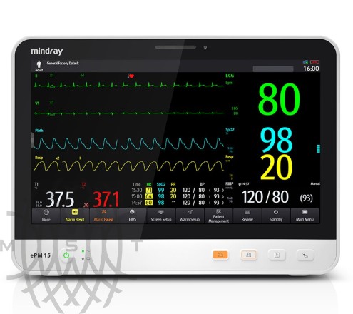 Mindray ePM 15 bemor monitori