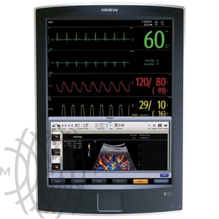 Mindray V21 bemor monitori