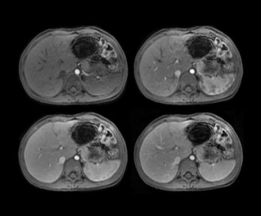 Магнитно-резонансный томограф GE SIGNA Architect 3T