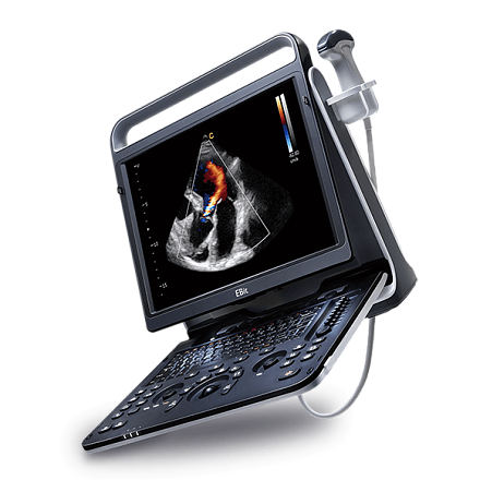 Chison EBit 60 аппарат УЗИ