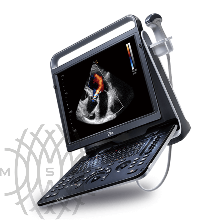 Chison EBit 60 аппарат УЗИ