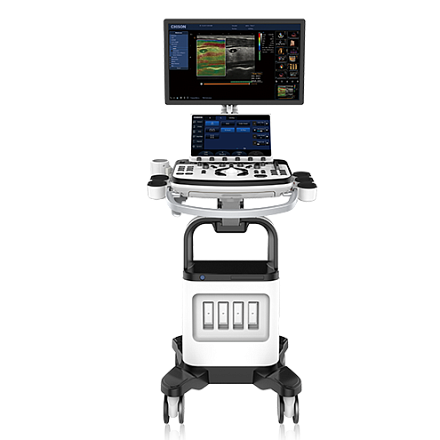 Ultratovush apparati Chison XBit 80