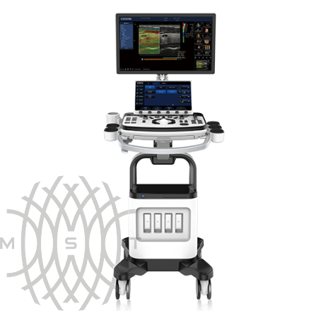 Ultratovush apparati Chison XBit 80