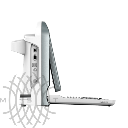 УЗИ аппарат Chison ECO 5