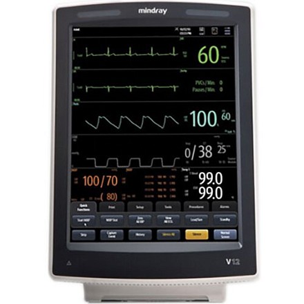 Mindray V12 bemor monitori