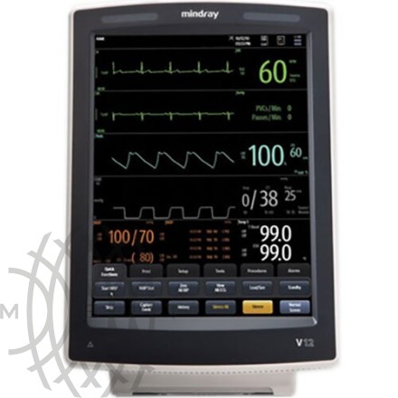 Mindray V12 bemor monitori