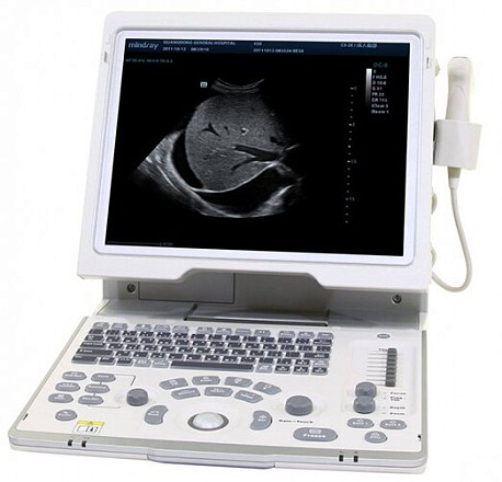 Mindray DP-50 УЗИ аппарат портативный