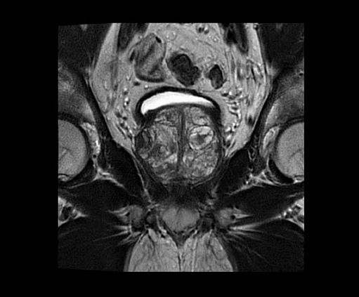 Магнитно-резонансный томограф GE SIGNA Architect 3T