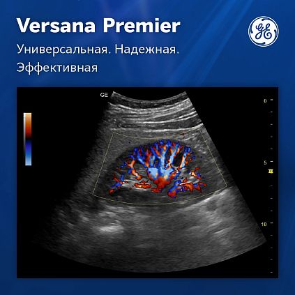 Ультразвуковая система GE Versana Premier Platinum