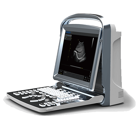 УЗИ аппарат Chison ECO 1