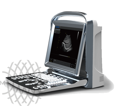 УЗИ аппарат Chison ECO 1