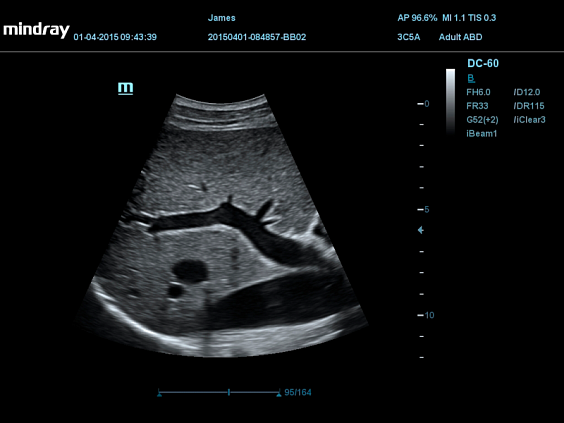 УЗИ аппарат Mindray DC-55