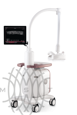 GE Invenia ABUS ultrasonik tizim