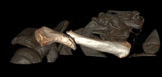 Компьютерный томограф GE Optima CT540 16 (32)