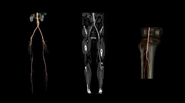 Компьютерный томограф GE Optima CT520 16 (32)