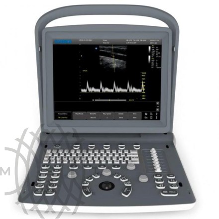 УЗИ аппарат Chison ECO 2