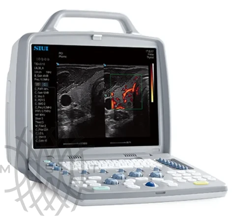 SIUI CTS-8800 аппарат УЗИ