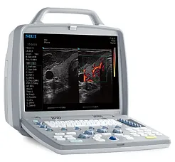 SIUI CTS-8800 аппарат УЗИ