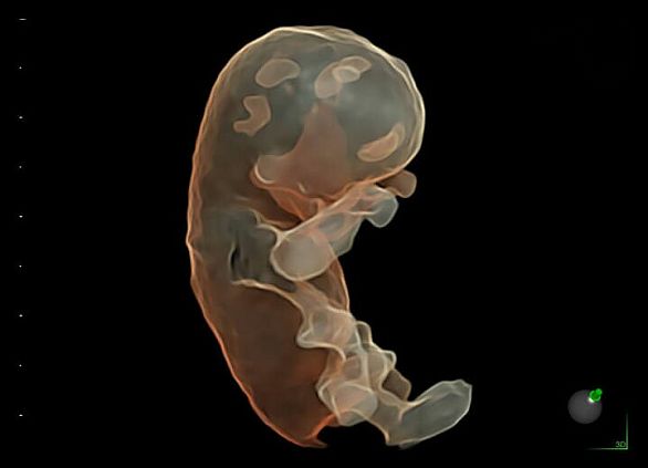 GE Voluson E6 аппарат УЗИ