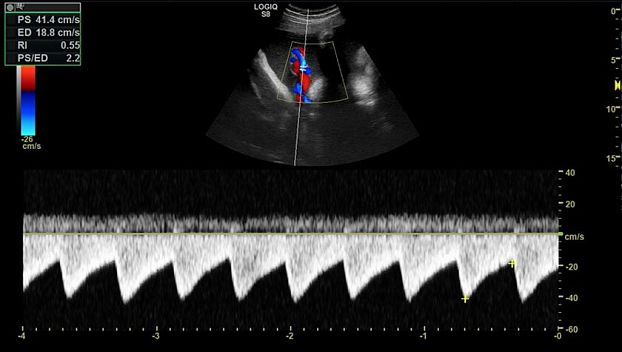 GE Logiq S8 XDclear ультразвуковая диагностическая система