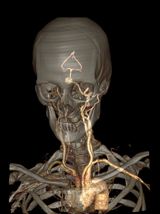 Компьютерный томограф GE Optima CT540 16 (32)