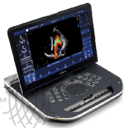 GE Vivid iQ portativ ultratovush diagnostika tizimi