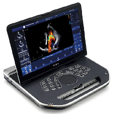 GE Vivid iQ portativ ultratovush diagnostika tizimi