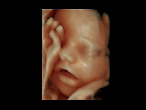 GE Voluson E10 аппарат УЗИ