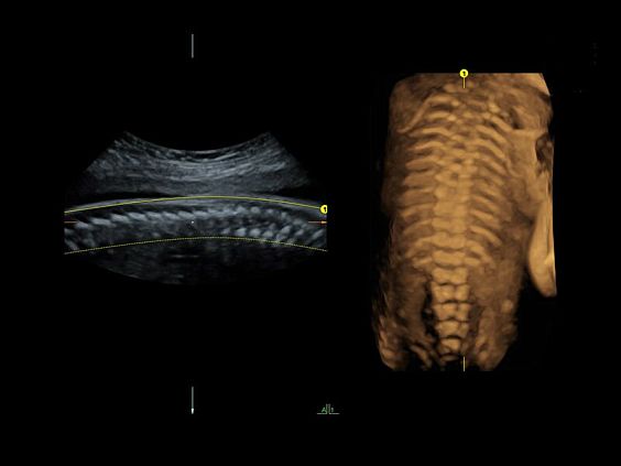 GE Voluson E10 аппарат УЗИ